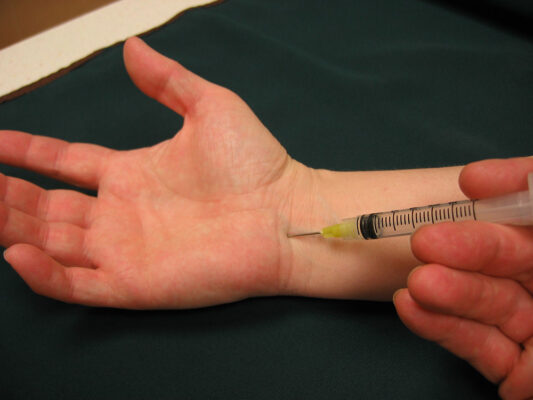 Đối với triệu chứng nhẹ có thể tiêm thuốc và nẹp tay để điều trị tại nhà