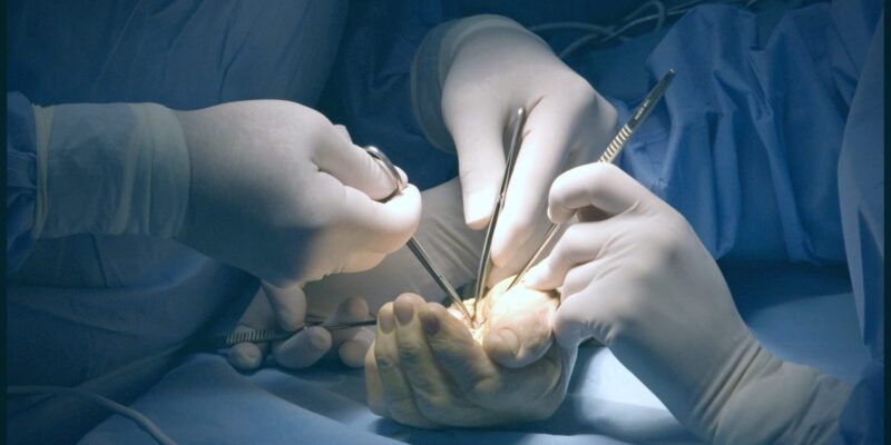 Chi phí phẫu thuật hội chứng ống cổ tay sẽ được chăm sóc chu đáo