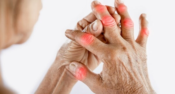 Đau cứng khớp ngón tay là triệu chứng thường gặp gây đau nhói