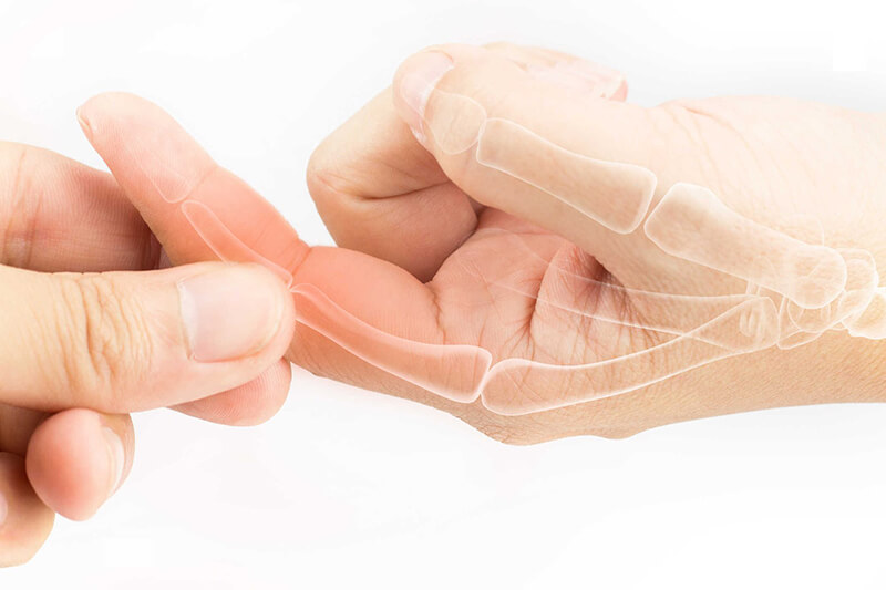 Triệu chứng ngón tay không duỗi thẳng được thường xuất hiện ở những người làm nghề nghiệp đòi hỏi phải uốn và duỗi ngón tay thường xuyên