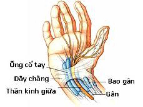 Có nhiều nguyên nhân dẫn tới tình trạng đứt gân bàn tay