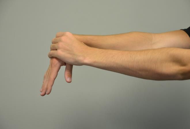 Một số biến chứng thường gặp sau khi tiến hành giải phẩu gân gấp ngón tay