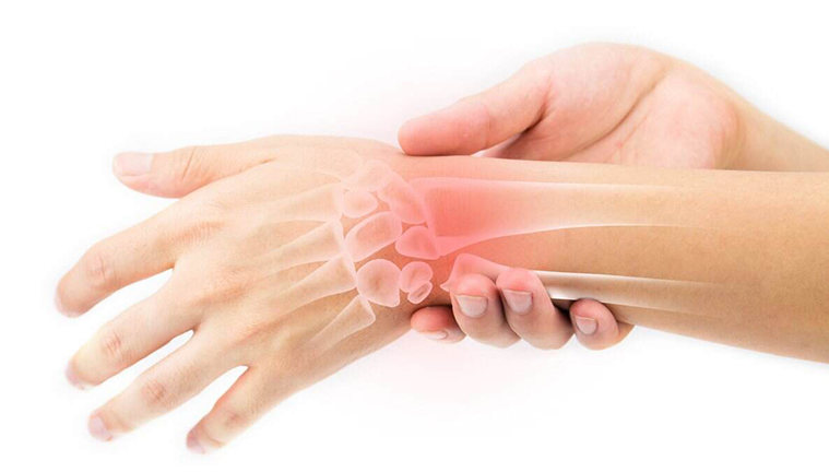 Hội chứng ống cổ tay là một trong những lí do gât ra hiện tượng ngón tay bị sưng.