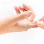 Ngón tay cò súng: dấu hiệu và cách nhận biết