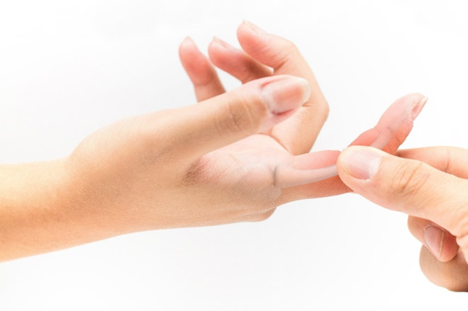 Ngón tay cò súng: dấu hiệu và cách nhận biết